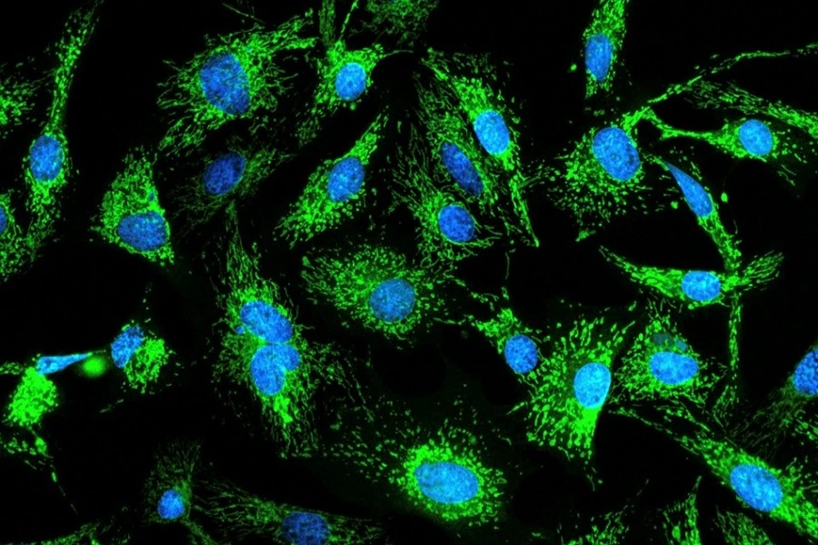 green flourescent cells under microscope against black backdrop